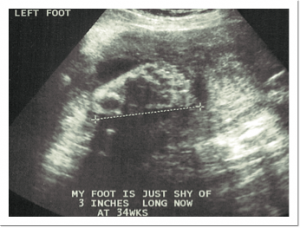 ultrasound1_6-10-08 He\'s got my feet!