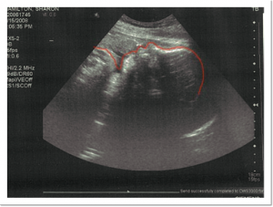 Baby Noah at 39 weeks :)