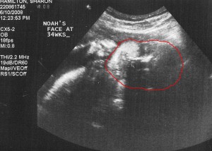 ultrasound2_6-10-08