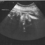 ultrasound_8_11_2009 Ultrasound image of Nora's profile on 8-11-2009 at 34 weeks.